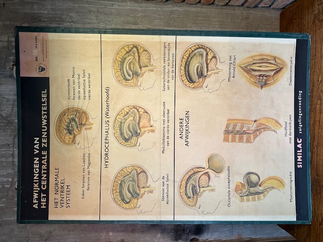 Vintage schoolplaten